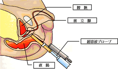 前立腺でイッキ抜き*お相手は無邪気な博士 - 三雲譲 -