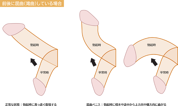 栗たろうと芋のすけ / その515.チンコのご機嫌