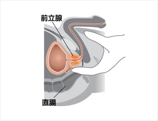 前立腺肥大で見られる症状 - 医療法人神楽岡泌尿器科