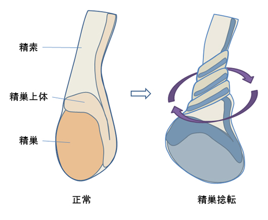 結局どこが良いの？ちんポジのあれこれを調査してみた｜BLニュース ちるちる