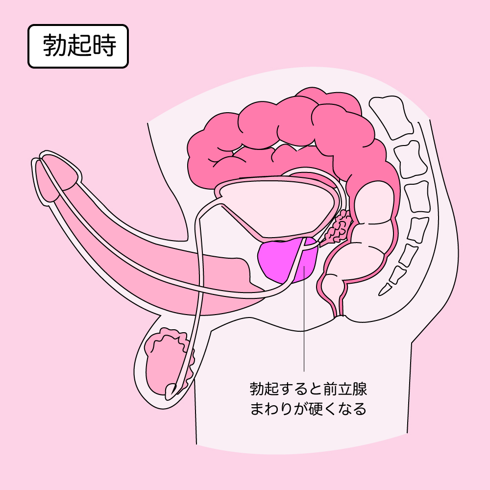 前立腺全摘術を受けられる患者様へ