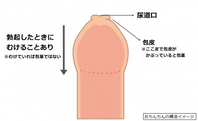 ペニスが曲がってる原因と治し方。お金をかけずにまっすぐに治す！ | VOLSTANISH