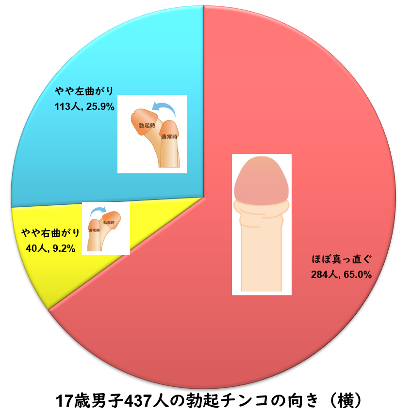 屈曲ペニス・屈曲陰茎・湾曲ペニスの詳細｜銀座みゆき通り美容外科！[東京・大阪]