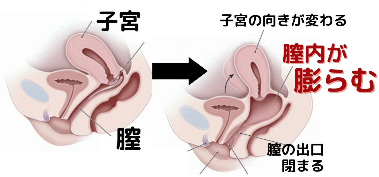 ペニスの曲がり】上反りちんこでの激痛と改善法を解説【アナル挿入の向きと角度】 - エロいアナル大好き！アダルトアブノーマルな出会い