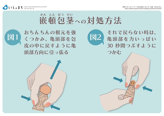 女性に好かれる上反りペニスとは？上向きペニスとの違いやトレーニング方法など | ザヘルプM